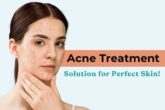 acne treatment in delhi