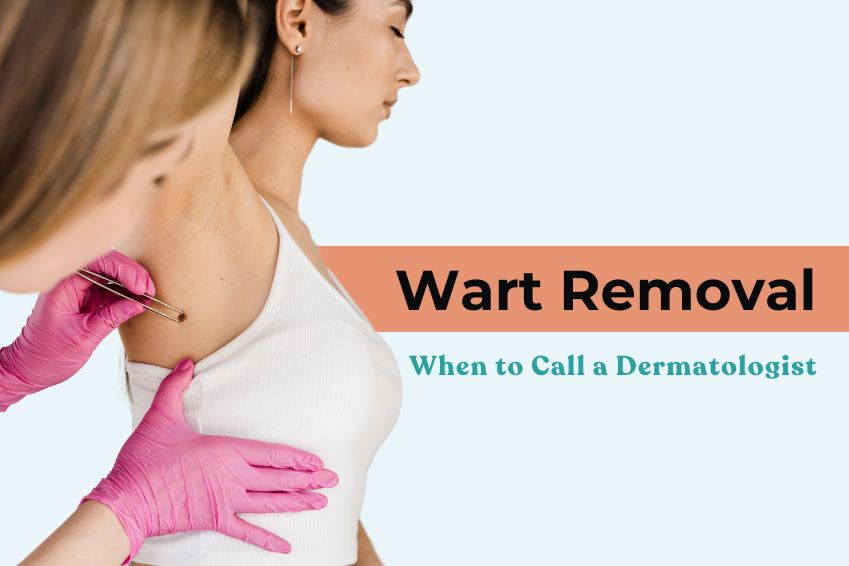 Wart Removal