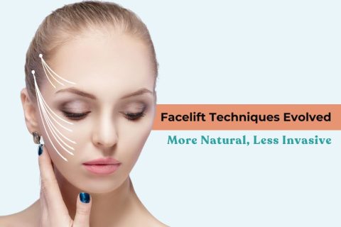 Face Lift Treatment