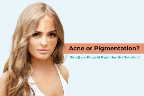 Acne or Pigmentation