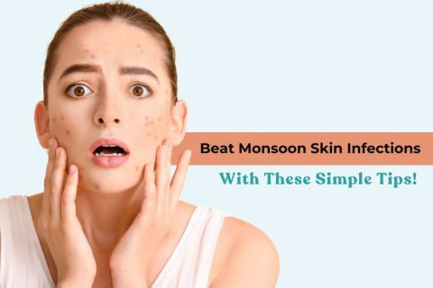 Monsoon Skin Infections