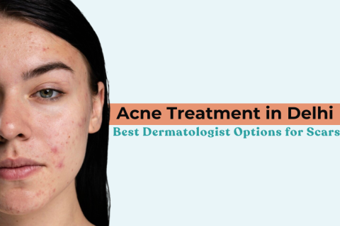 Acne Treatment in Delhi – Woman with acne scars on face, highlighting dermatologist options for scar reduction