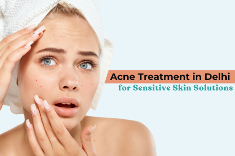 Young woman with sensitive skin touching face with acne spots, promoting expert Acne Treatment in Delhi for gentle and effective solutions.