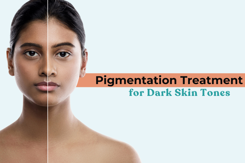 Pigmentation treatment for dark skin tones showing before and after results with even skin tone improvement.