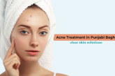 Young woman with towel on head touching acne spots on her face, representing professional acne treatment in Punjabi Bagh for clear and healthy skin solutions.