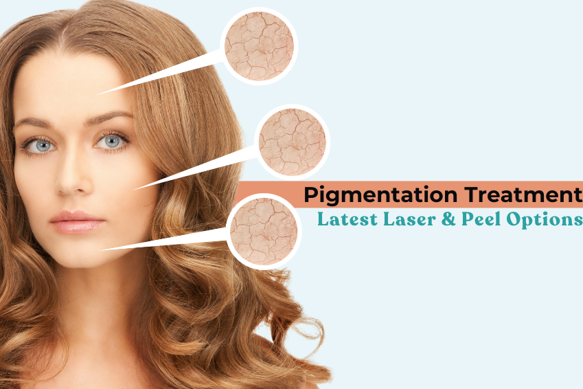 A woman with clear, glowing skin is shown with close-up circles highlighting areas of pigmentation. The image illustrates pigmentation issues and modern skin care solutions. Text on the image reads “Pigmentation Treatment: Latest Laser & Peel Options,” suggesting advanced cosmetic treatments for even-toned, radiant skin.