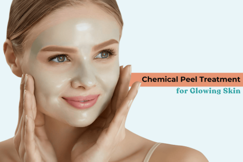 Woman with a glowing face applying a chemical peel mask during Chemical Peel Treatment for smoother, radiant skin.