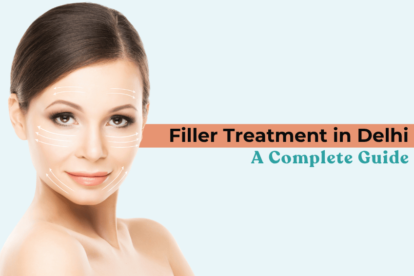 Woman with facial contour lines showing filler treatment areas – Filler Treatment in Delhi: A Complete Guide by SkinQure